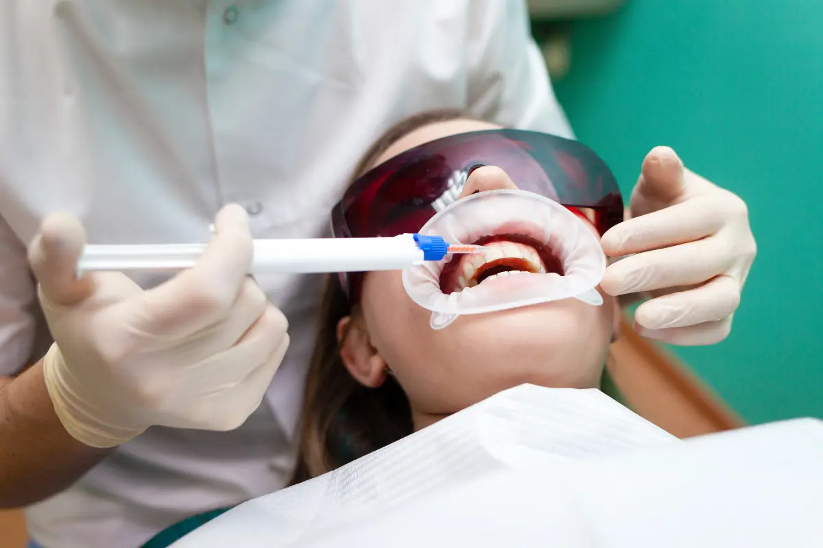 Clareamento Dental: Um Sorriso mais Radiante - dentista fazendo clareamento dental numa paciente