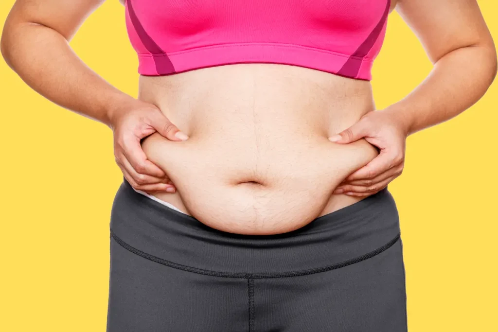 Coolsculpting Tratamento Para Gordura Localizada - mulher apertando a gordura localizada da barriga