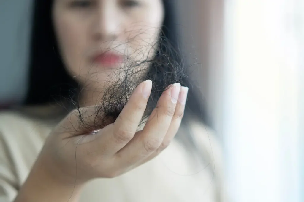 Mulher com queda de cabelo segurando um pouco de cabelo em suas mãos