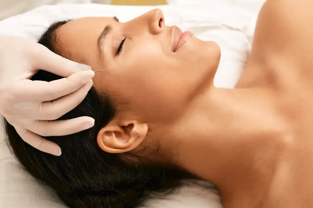 Mulher fazendo o procedimento estético de Lifting facial