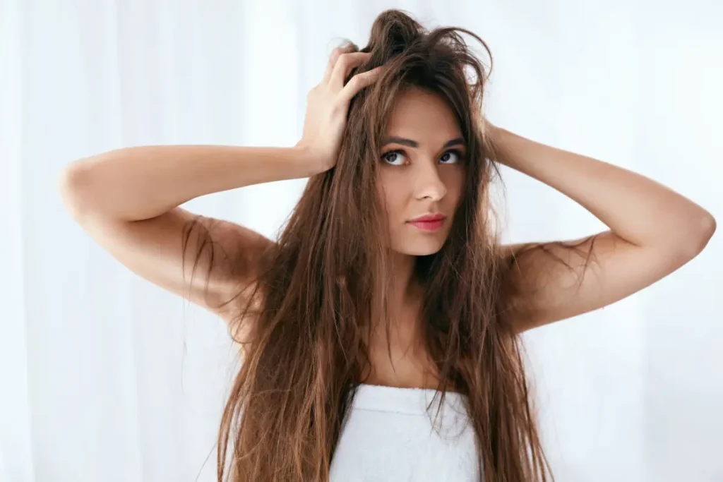 Cabelos Secos 6 Dicas Para Devolver a Vida dos Seus Fios - Mulher com cabelo danificado