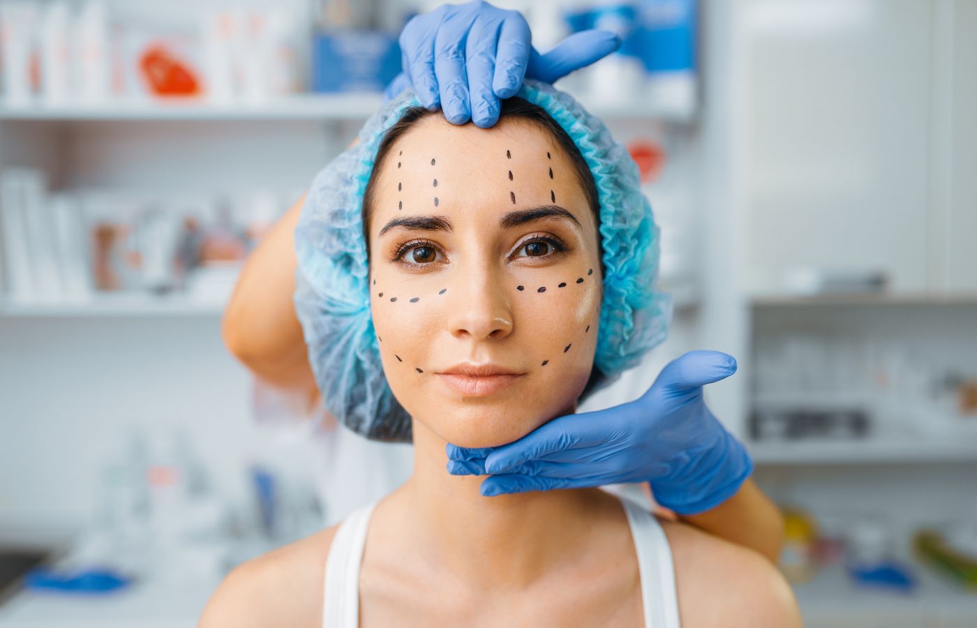 Profissional fazendo as marcações de onde será aplicado o microbotox