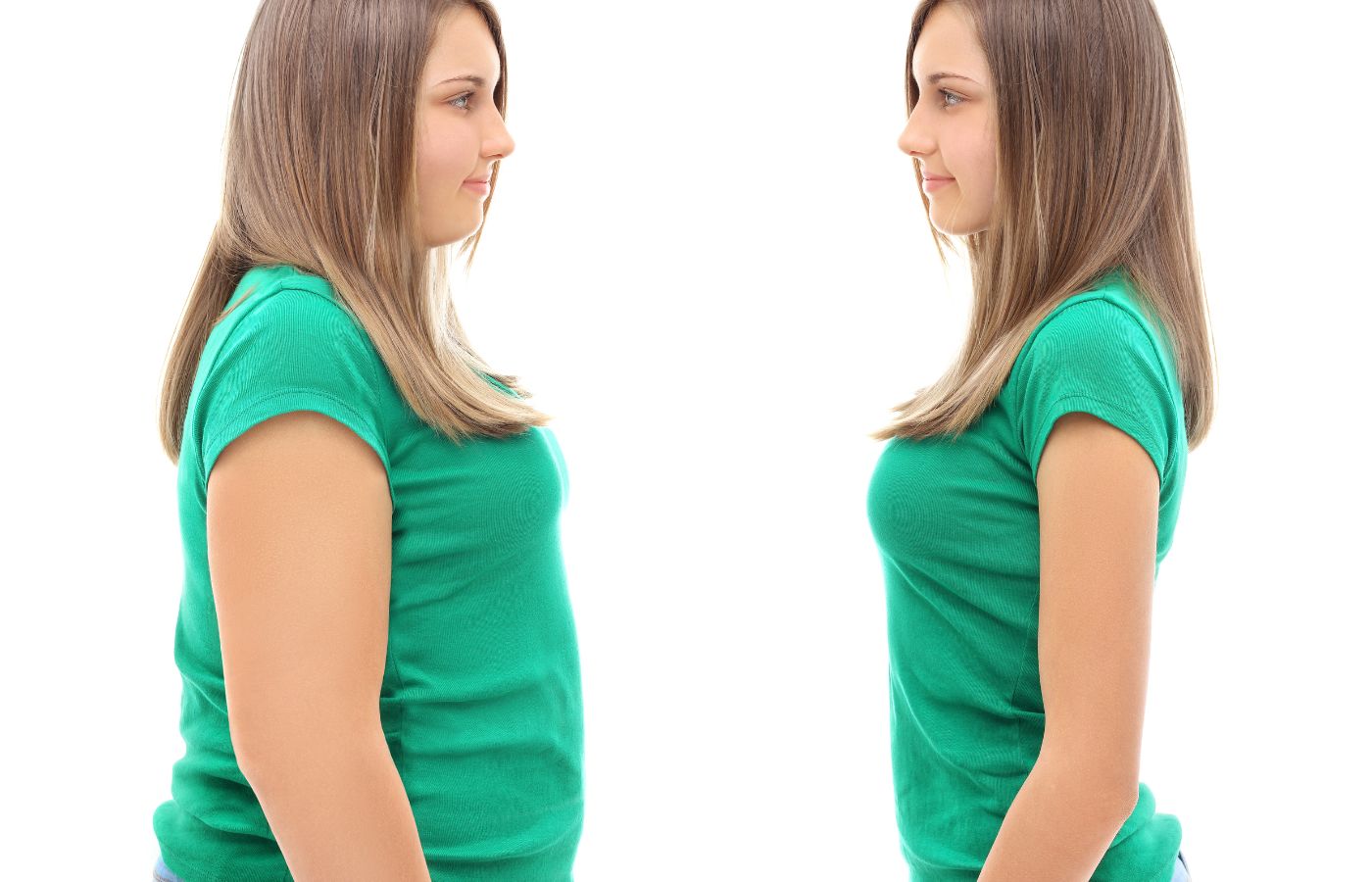 Mulher antes e depois de emagrecimento (Imagem: Reprodução da Internet)